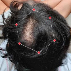 Krishnan R – During