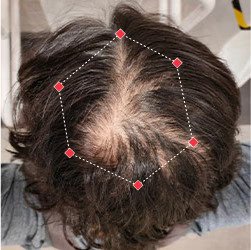 Krishnan R – Before