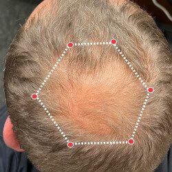 Tushar Kapoor – Before