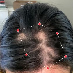 Shreyashi – Before